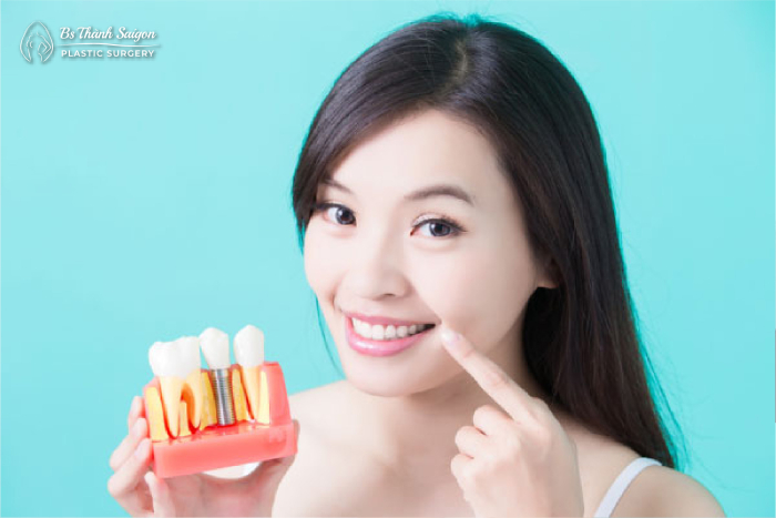 Cấy ghép Implant là gì? ưu và nhược điểm khi cấy ghép Implant bạn cần biết?